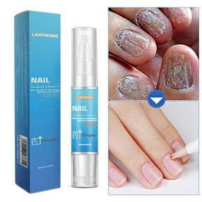 Tratamento de Reparação de Unhas Líquido Removedor de Fungos - Loja Ammix